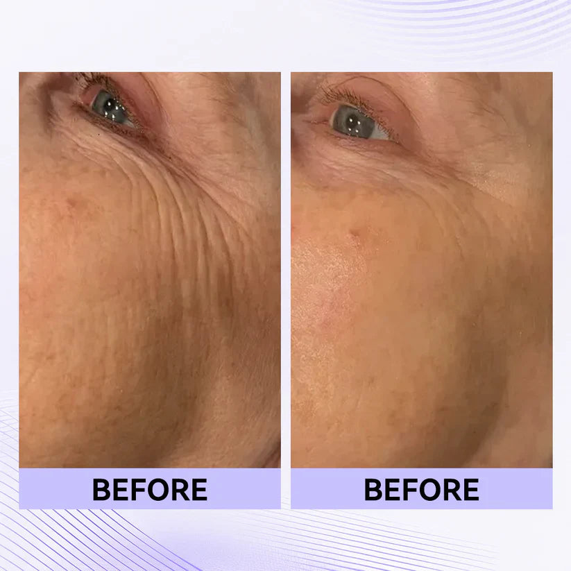 Instant Eye Tightener
