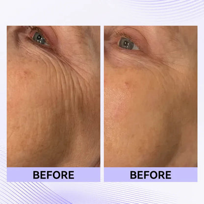 Instant Eye Tightener
